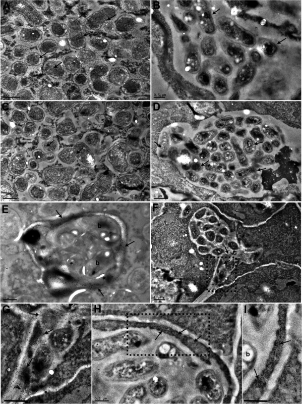 Transmission electron micrographs of <i>Lotus japonicus</i> nodules colonised by <i>M</i>. <i>loti exoU</i> or by <i>R</i>. <i>mesosinicum</i> KAW12.