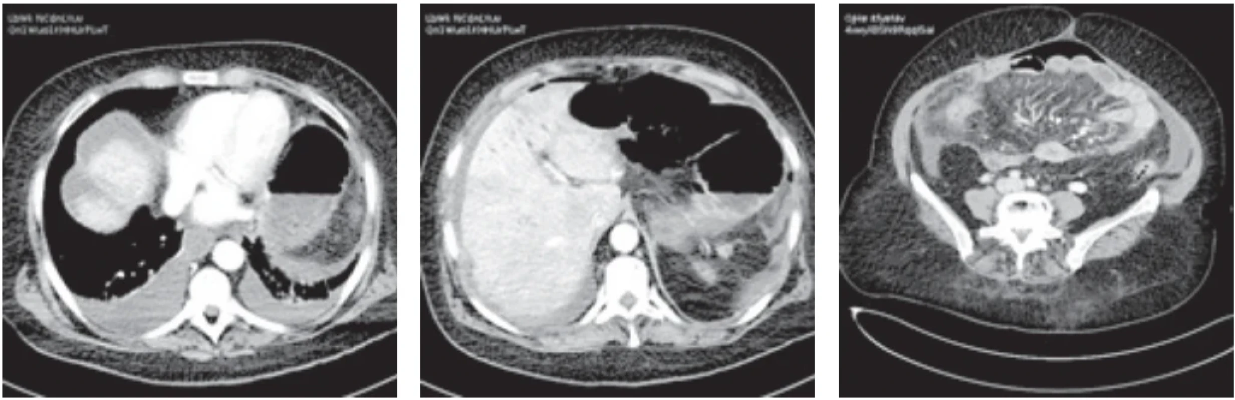  / Fig. 2.
