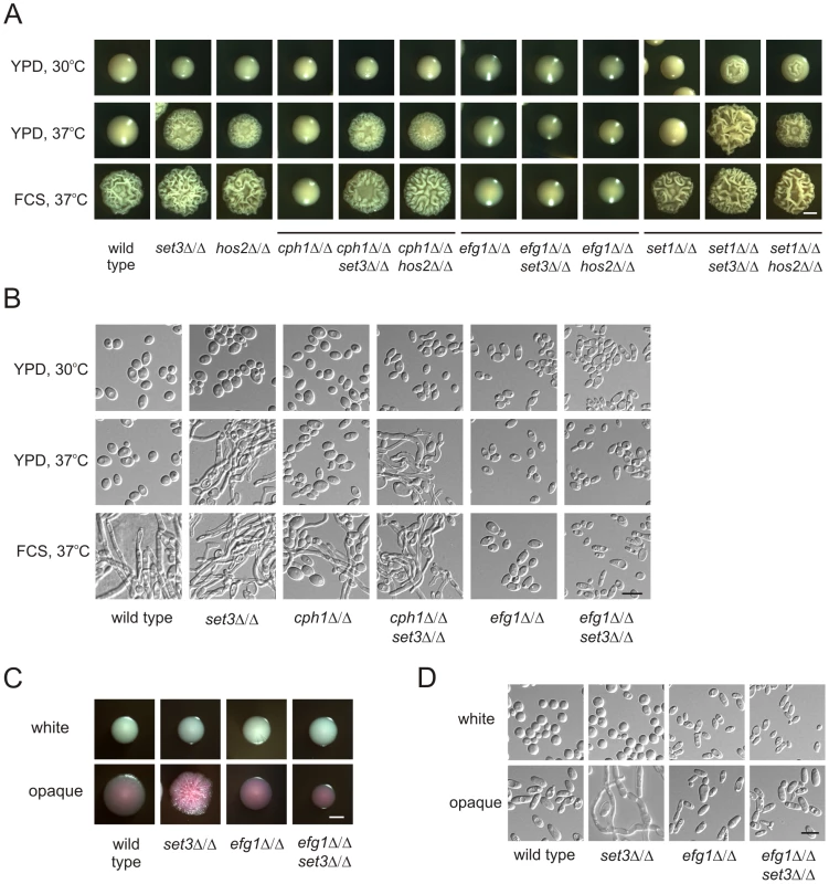 Lack of <i>EFG1</i> suppresses hyperfilamentation of <i>set3</i>Δ/Δ and <i>hos2</i>Δ/Δ mutants.