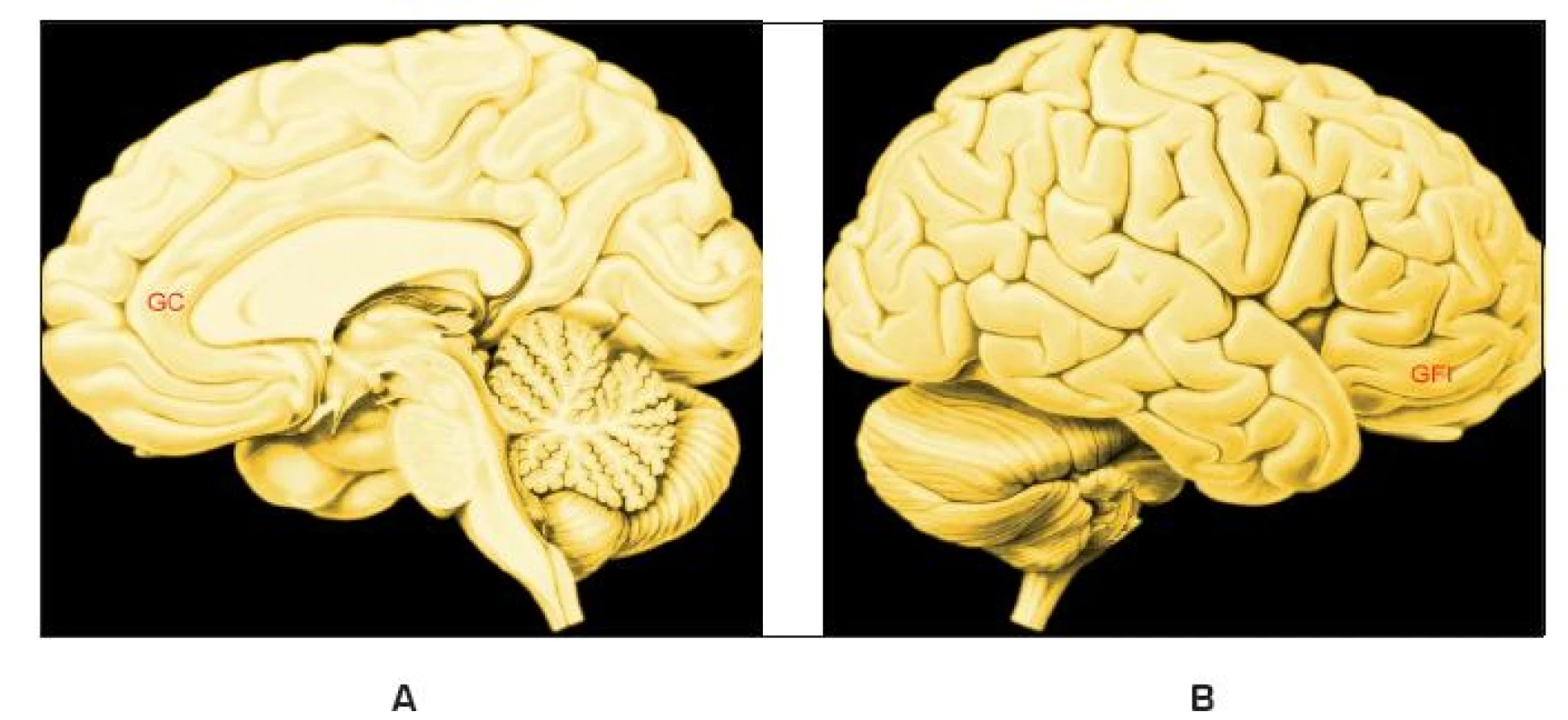 Stroopův test
Legenda:
A – Vnitřní plocha pravé hemisféry;
B – Zevní plocha pravé hemisféry;
GC – Přední část gyrus cinguli (opaskový závit);
GFI – Gyrus frontalis inferior, dolní čelní závit;
Obě korové oblasti aktivuje konfliktní situace: jestliže čteme slovo červený vytištěné modrou barvou, trvá poznání slova déle, než čteme-li slovo červený vytištěné červenou barvou (to je jedna z mnoha podob Stroopovu testu vytvořeného v r. 1935)