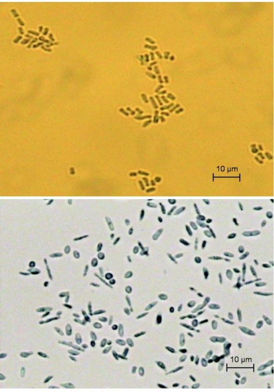 a, b A. kalrae, artrokonídiá, fuziformné a guľovité konídiá (Sabouraudov agar, vláknitá forma, 25 °C, preparát v laktofenole)
Fig. 2a, 2b Arthrographis kalrae, fusiform and spherical conidia (Sabouraud agar, filamentous form, 25°C, mount in lactophenol)