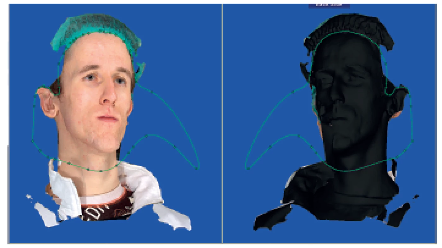 Odstranění nepotřebných dat