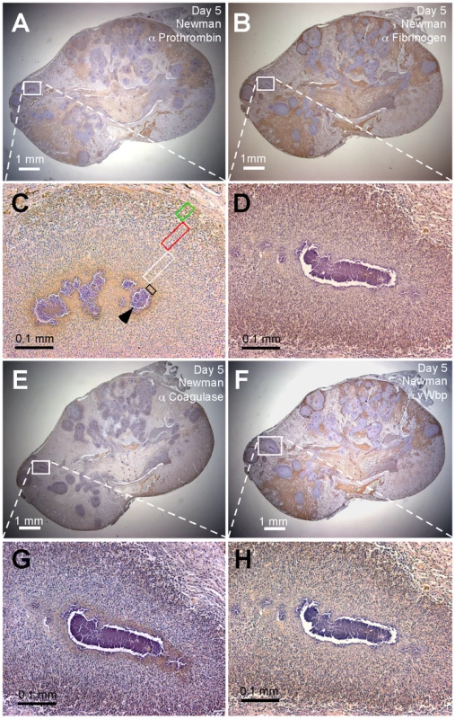 Localization of prothrombin, fibrinogen, coagulase (Coa), and von Willebrand factor binding protein (vWbp) in staphylococcal abscesses.