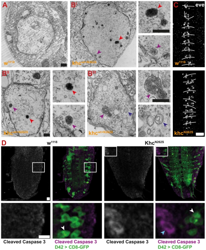 Analysis of NMJ degeneration and apoptosis.