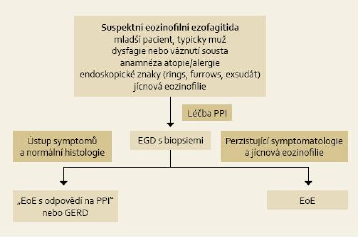 Nový návrh definice a diagnostického postupu u pacienta se suspektní EoE [4].
Fig. 1. Newly proposed definition and diagnostic procedure in a patient with suspected EoE [4].