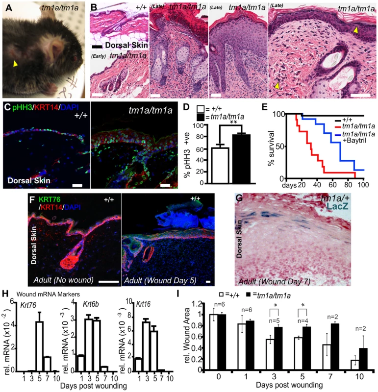 <i>Krt76</i> is required for normal wound healing.
