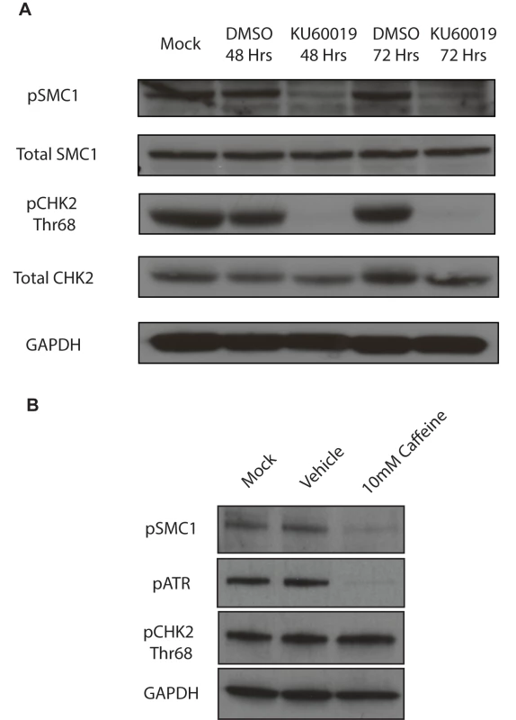 SMC1 is phosphorylated by both ATM and ATR.
