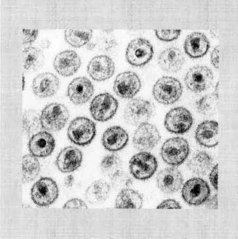 Elektronmikroskopický snímek HIV
Fig. 3. Electron microscopy image of HIV