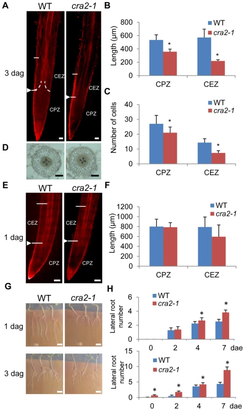 The <i>cra2</i> lateral root and root apical meristem phenotypes can be disconnected.