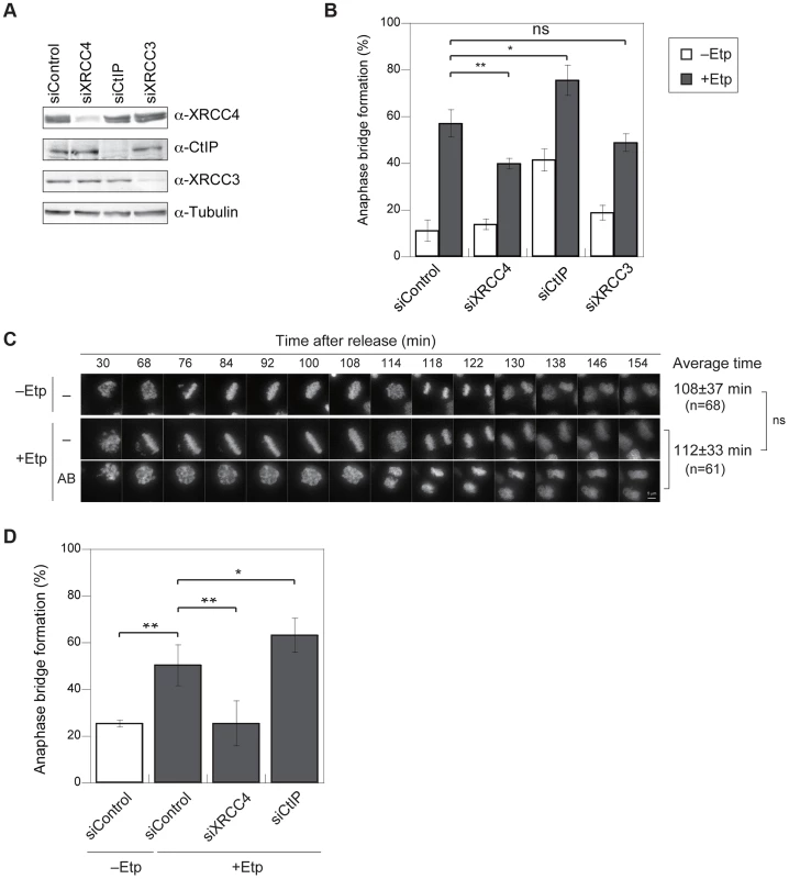 Anaphase bridges are formed by NHEJ and HR and are inhibited by CtIP-dependent end resection.