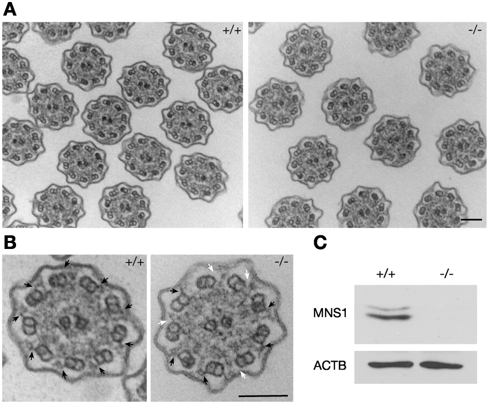Defects in outer dynein arms in <i>Mns1</i>-deficient tracheal cilia.