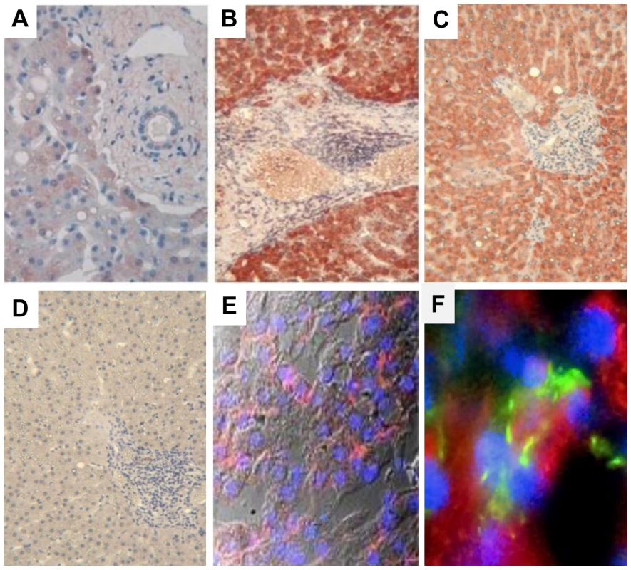 MIC proteins are overexpressed in HCV-infected liver.
