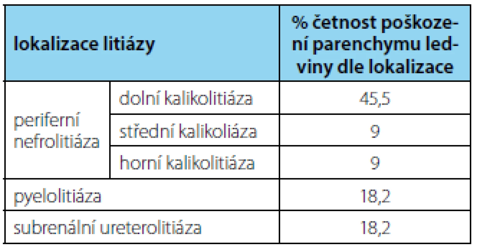 Vztah lokalizace litiázy a rizika poranění parenchymu ledviny v důsledku LERV
Tab. 2 Relation of location of the lithiasis and the risk of renal parenchymal injury due to ESWL