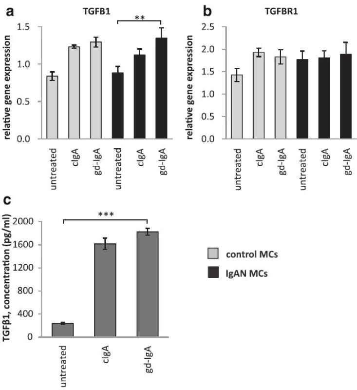 Gene expression of TGFB1 and TGFBR1 and release of TGFβ1. Mesangial cells (MCs) from patients with IgA nephropathy (IgAN) and controls were stimulated with IgA1 purified from blood from healthy controls (cIgA) or patients with IgAN (gd-IgA) or medium only for 6 h and the gene expression was investigated. Stimulation of control MCs and IgAN MCs with gd-IgA gave a significant increase in the gene expression of TGFB1 (gene coding for TGFβ1) (a). The gene expression for TGFBR1 (gene coding for TGF-beta receptor type-1) was not significantly affected by any of the treatments (b). IgAN MCs were stimulated with either cIgA or gd-IgA for 6 h and the release of TGFβ1into the cell culture medium was investigated. Both treatment with cIgA and gd-IgA resulted in an increased release of TGFβ1 compared to untreated cells (c). <i>Grey bars</i> represent control MCs, <i>black bars</i> represent IgAN MCs * <i>P</i> < 0.05, ** <i>P</i> < 0.01, ***<i>P</i> < 0.001, error bars represent SEM