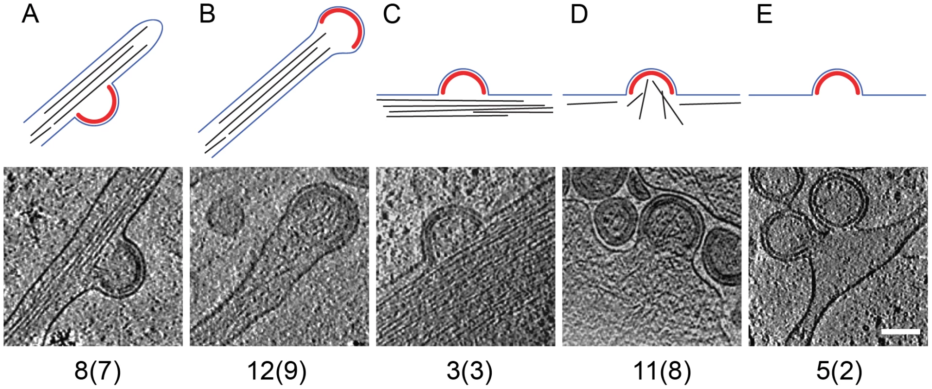 Filamentous actin at HIV-1 budding sites.