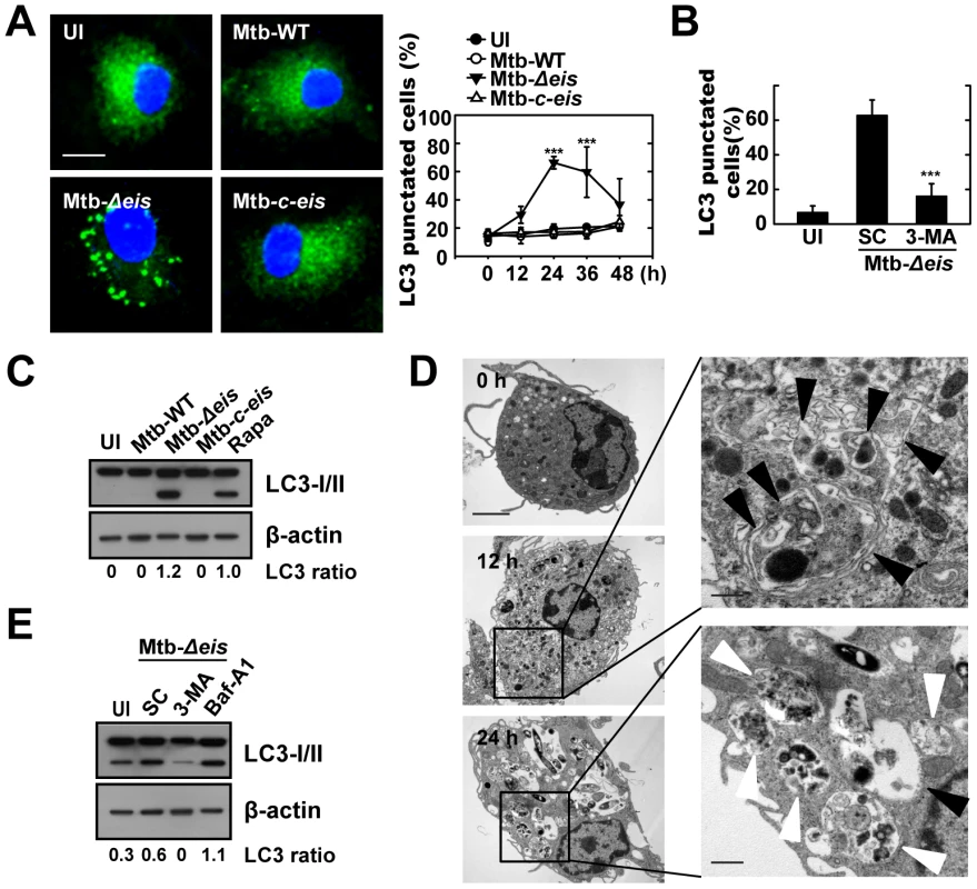 Mtb Eis modulates autophagy in macrophages.