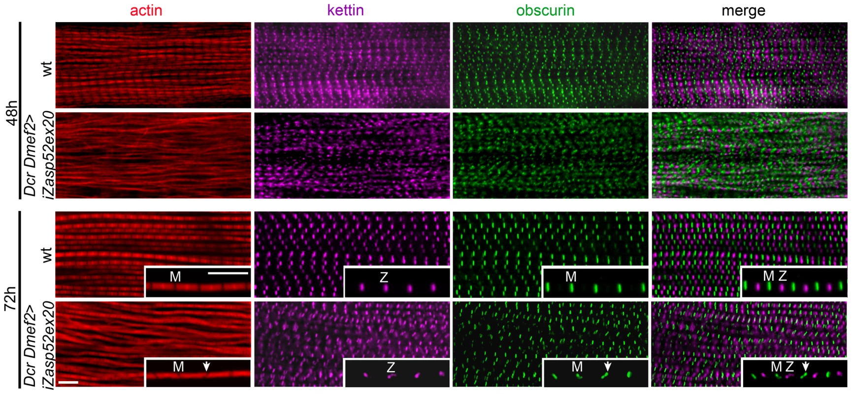 Zasp52 long isoforms are required for pupal myofibril development.