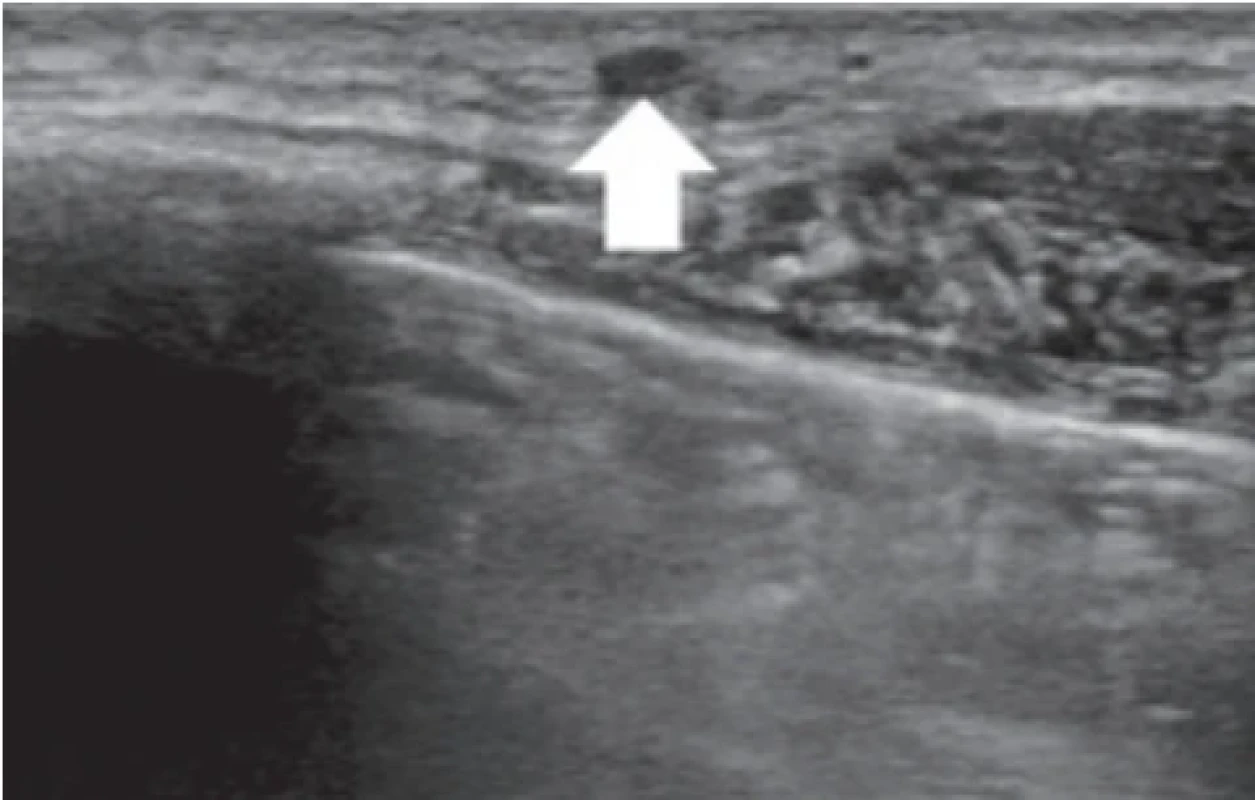  / Fig. 3.