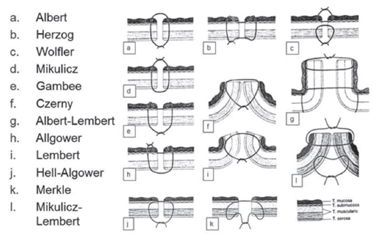 Přehled základních šicích technik při konstrukci střevní anastomózy dle jejich tvůrců
Fig. 1: Overview of essential suture techniques for bowel anastomosis construction according to orginal authors