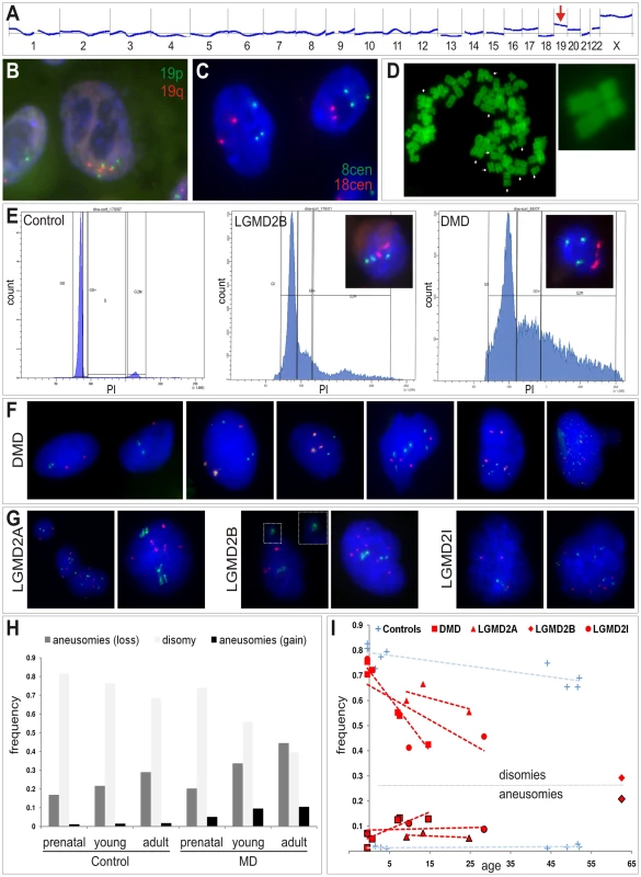 Somatic aneuploidy in human muscular dystrophies.