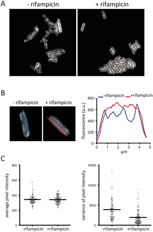 Rifampicin treatment inhibits formation of RNase E foci. Images are of the KSL2000/pVK207 strain, which expresses RNase E-YFP.