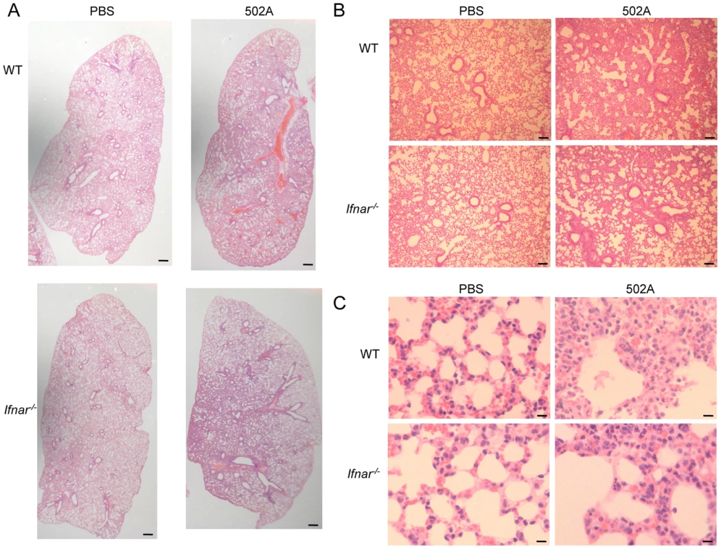 Type I IFN signaling contributes to pulmonary pathology in response to <i>S. aureus</i> 502A.