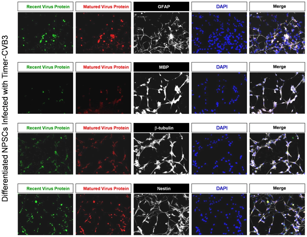 Inspection of recent and matured virus protein expression in differentiated NPSCs infected with Timer-CVB3.