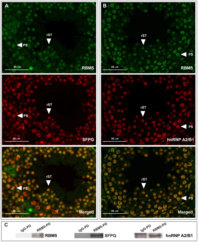 RBM5 co-localises and interacts with splicing factors hnRNP A2/B1 and SFPQ in male germ cells.