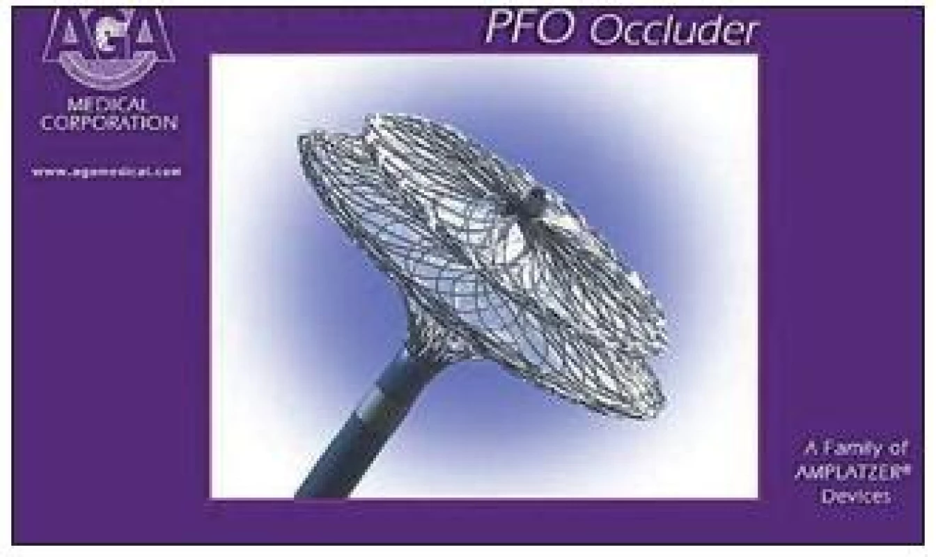 Amplatzův occluder k uzávěru foramen ovale patens