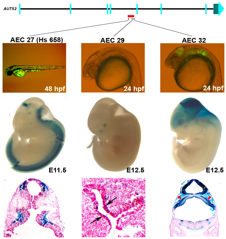 Enhancers within an ASD–associated <i>AUTS2</i> intronic deletion <em class="ref">[<b>5</b>]</em>.