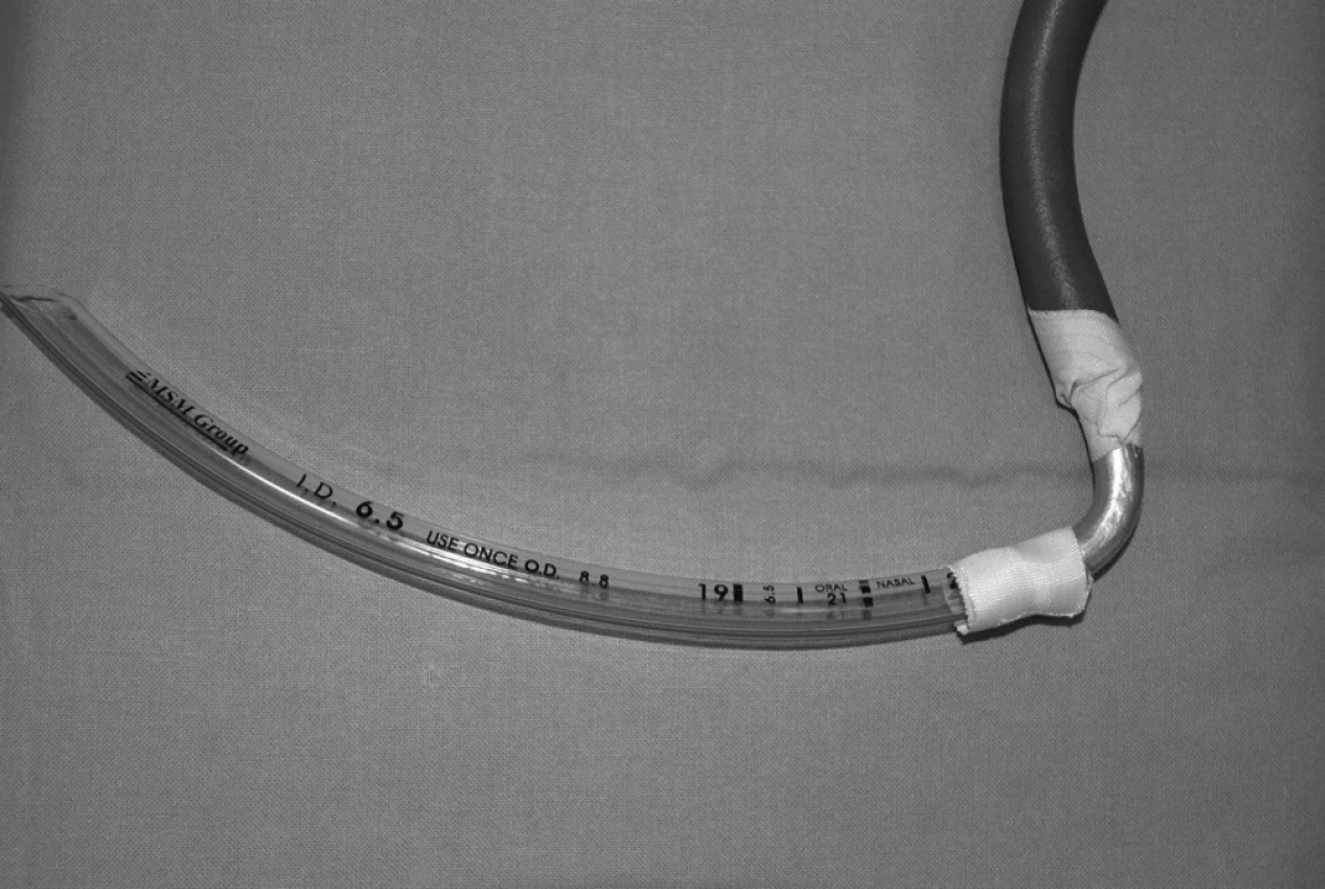 Zkrácená tracheální rourka, napojená přespravoúhlou spojku z rigidního materiálu na ventilační systém