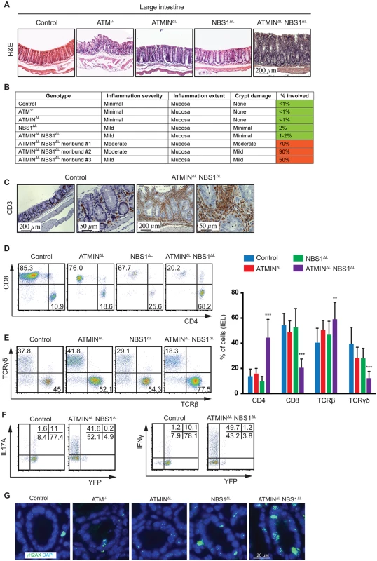 Loss of ATMIN and NBS1 leads to intestinal inflammation due to infiltration of cytokine-producing T cells.