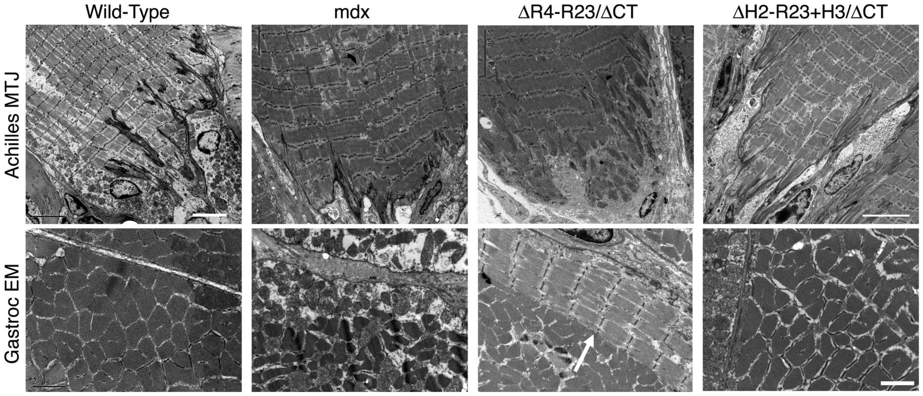The hinge domains of dystrophin influence myotendinous junction structure and ringed fiber formation.