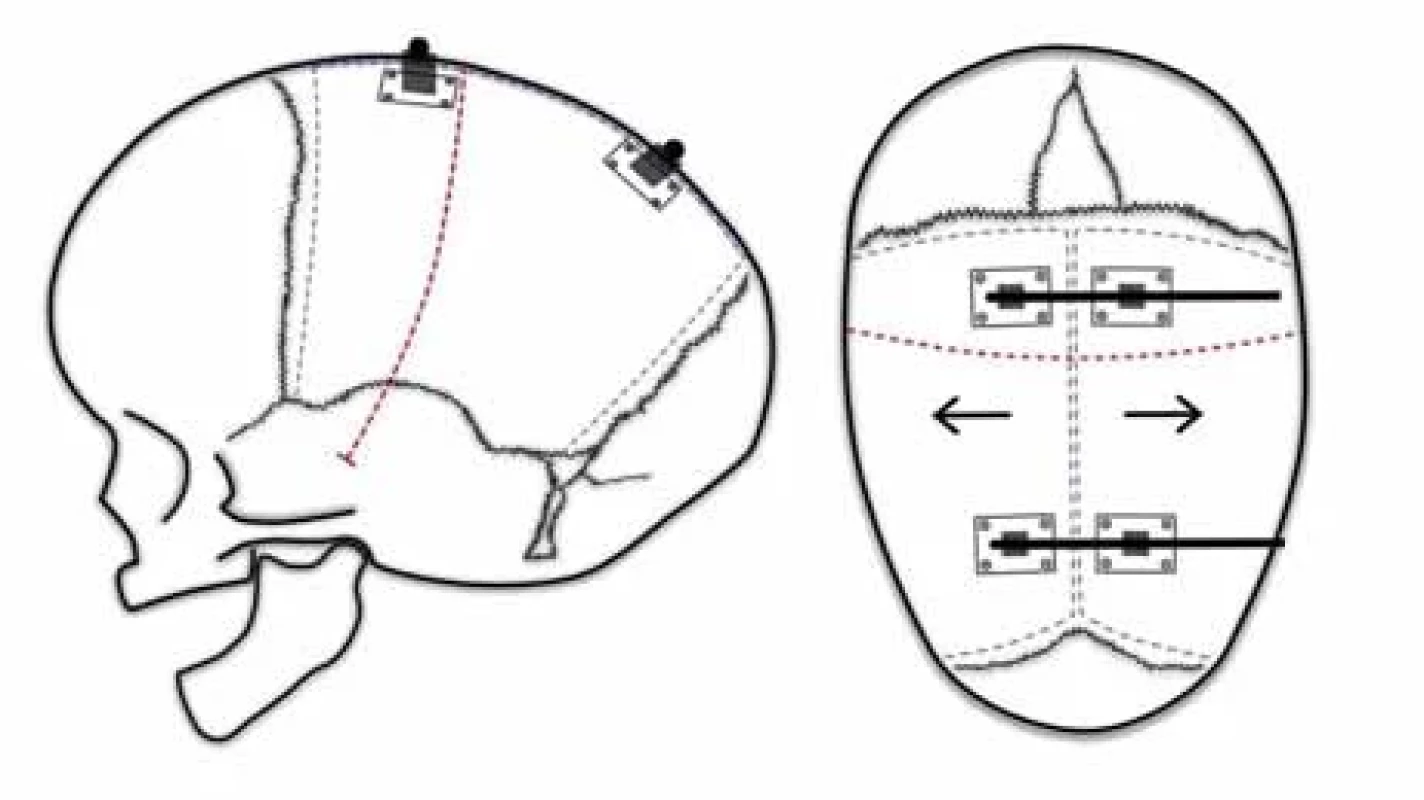 Distraktory / Fig. 9. Distractors