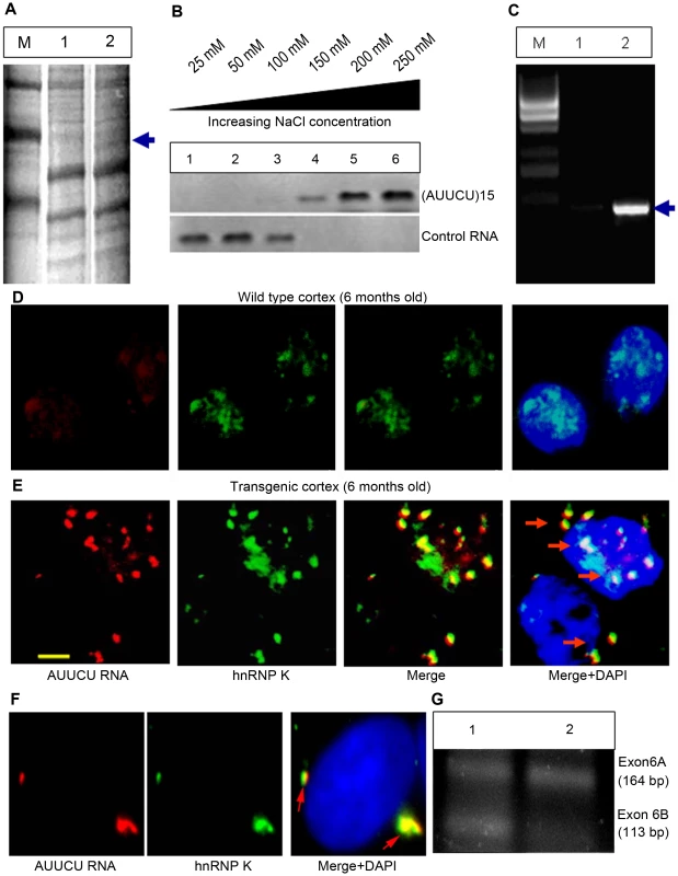 Expanded AUUCU-RNA binds to hnRNP K.