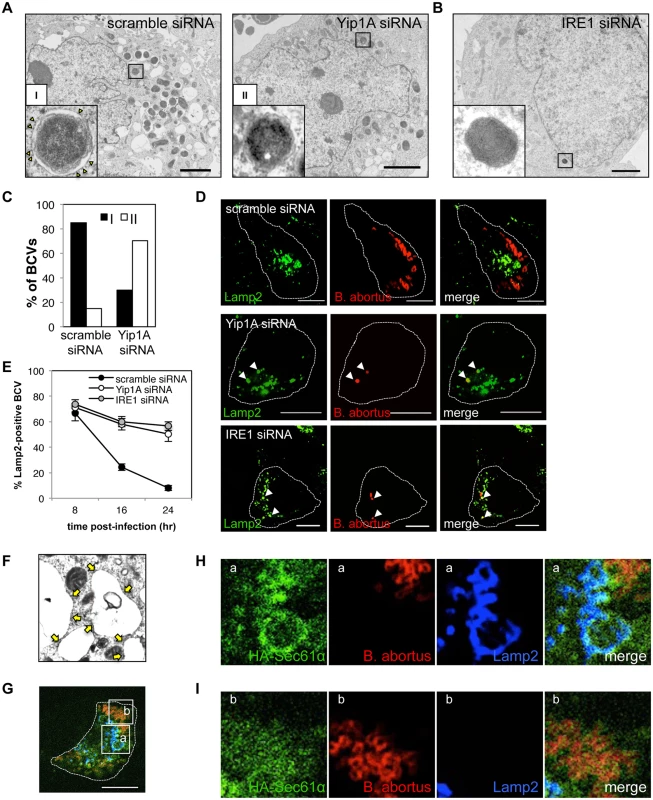 Yip1A-knockdown prevents maturation of <i>B</i>. <i>abortus</i> into ER-derived replicative BCVs, and confines BCVs within Lamp2-positive compartments.