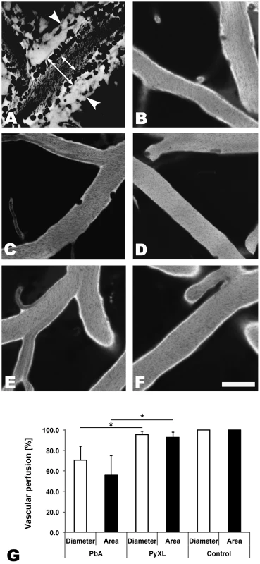 ECM correlates with microrheological alterations in postcapillary venules.