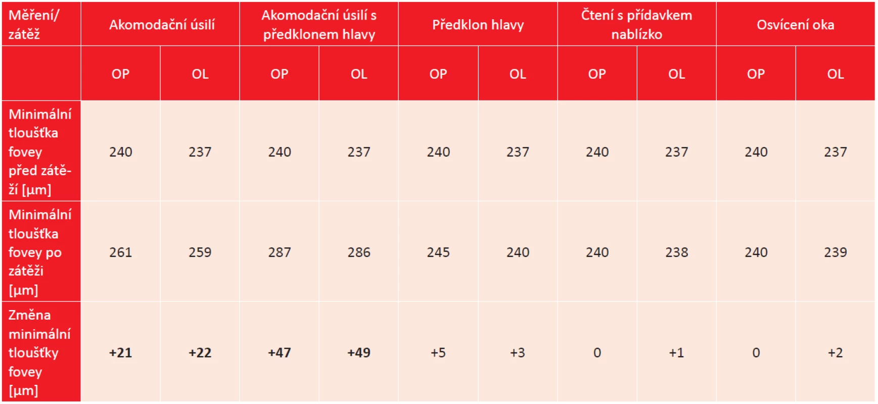 Změny minimální tloušťky fovey obou očí u 57leté pacientky s dynamickou vitreomakulární trakcí.