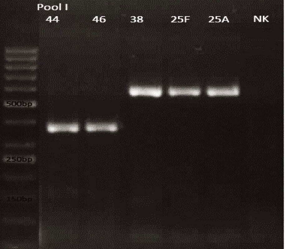mPCR pool I
Dráha 1: 50bp DNA Ladder
Dráha 2: <i>S. pneumoniae</i> sérotyp 44 (376bp)
Dráha 3: <i>S. pneumoniae</i> sérotyp 46 (376bp)
Dráha 4: <i>S. pneumoniae</i> sérotyp 38 (574bp)
Dráha 5: <i>S. pneumoniae</i> sérotyp 25F (574bp)
Dráha 6: <i>S. pneumoniae</i> sérotyp 25A (574bp)
Dráha 7: negativní kontrola
Dráha 2–6: pozitivní produkt cpsA (160bp)<br>
Fig. 9. mPCR pool I
Lane 1: 50bp DNA Ladder
Lane 2: <i>S. pneumoniae</i> serotype 44 (376bp)
Lane 3: <i>S. pneumoniae</i> serotype 46 (376bp)
Lane 4: <i>S. pneumoniae</i> serotype 38 (574bp)
Lane 5: <i>S. pneumoniae</i> serotype 25F (574bp)
Lane 6: <i>S. pneumoniae</i> serotype 25A (574bp)
Lane 7: negative control
Lanes 2–6: positive product cpsA (160bp)