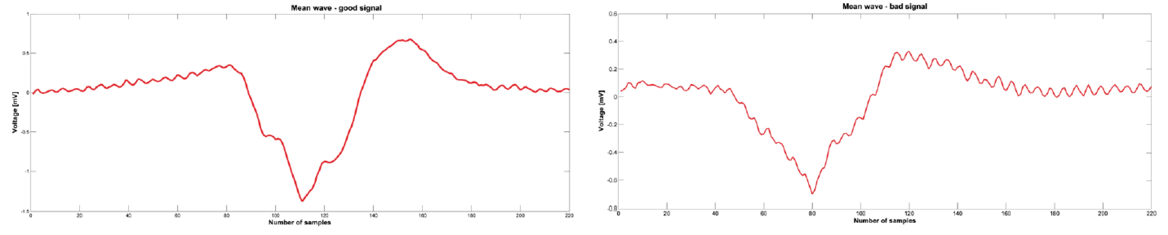Mean wave calculated from the detected atrial components. Left picture is calculated from the atrial components showed on the Fig. 3 and the mean wave is for good signal. Right picture is for bad signal.