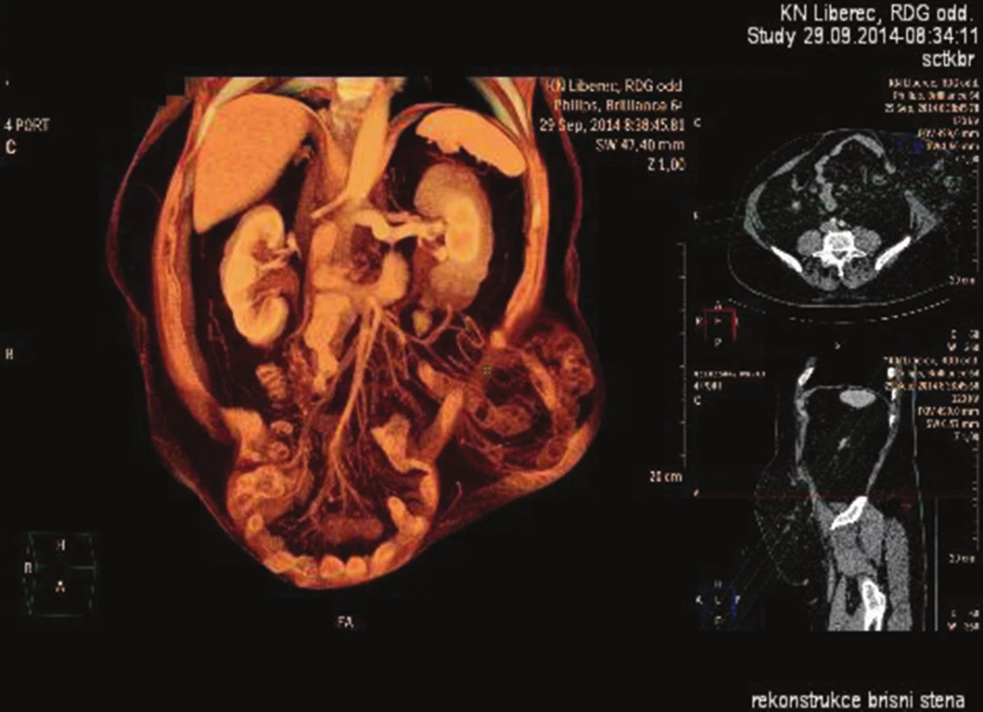 CT orgánová rekonstrukce
Fig. 4: CT organ reconstruction
