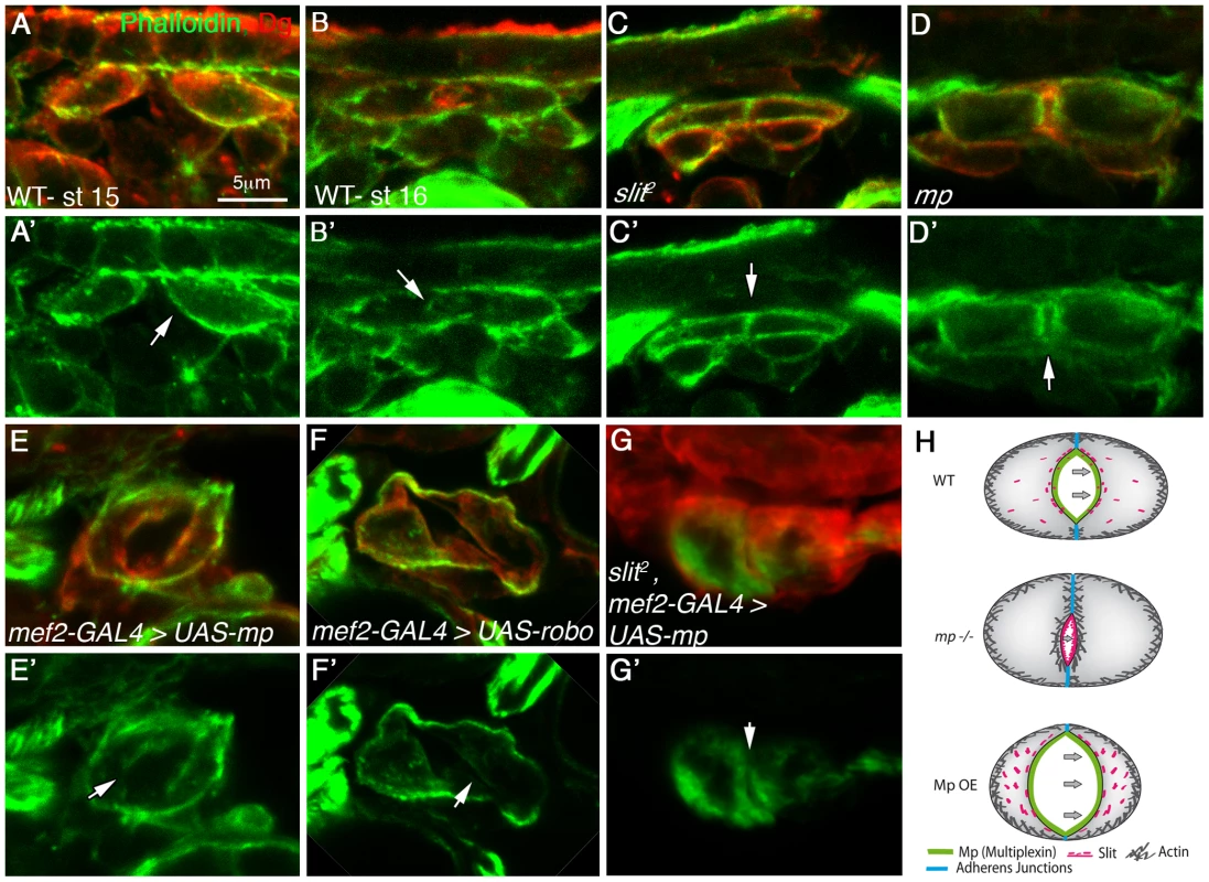 Mp activity reduces F-actin levels at the cardiac luminal membrane in a <i>slit</i> dependent manner.