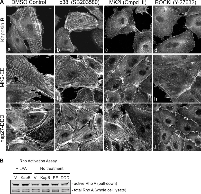 KapB requires the kinase MK2 and RhoA-GTPase to induce actin stress fibers in primary endothelial cells.