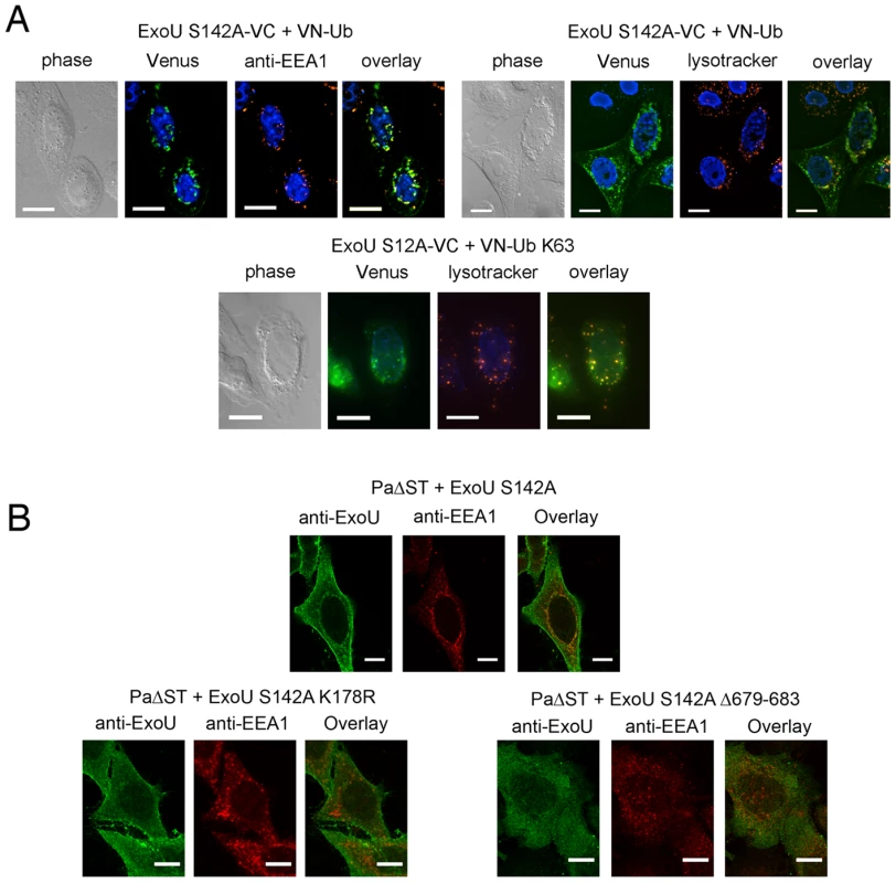 Ub-ExoU is targeted to endosomes.