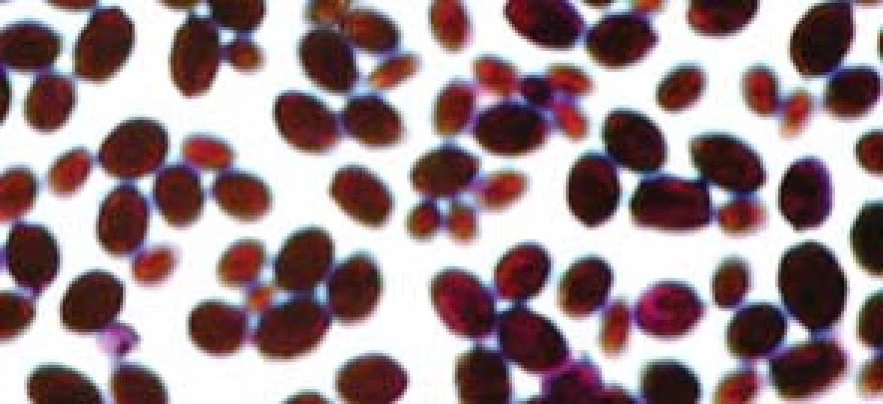 Candida glabrata.