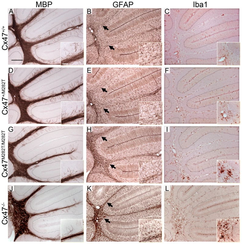 Deletion and mutation of Cx47 results in disturbed MBP expression accompanied by astrogliosis and microglial activation in juvenile mice.