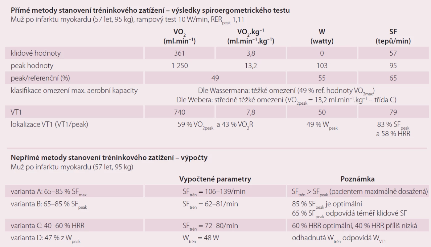 Ukázka přímých a nepřímých metod stanovení tréninkové zátěže u pacienta po akutním infarktu myokardu.