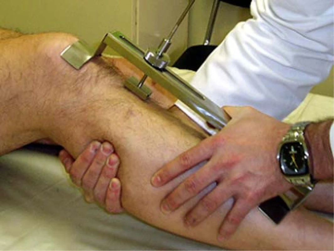 KT metr (Knee Translation)