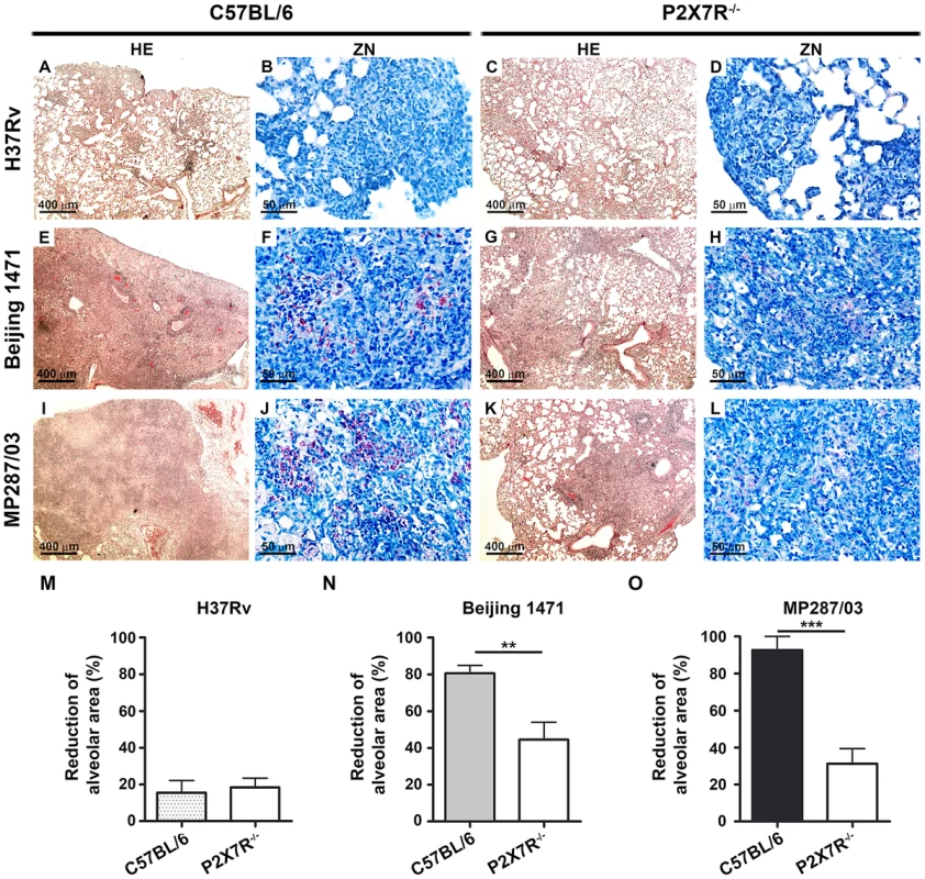 Lung histopathology in C57BL/6 and P2X7R<sup>−/−</sup> mice on day 28 p.i. with hypervirulent mycobacteria.