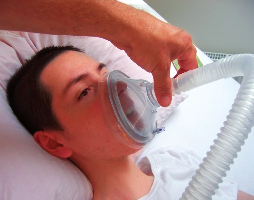 CoushAssist – aplikace přes obličejovou masku u nemocného s Duchennovou svalovou dystrofií (se souhlasem pacienta).